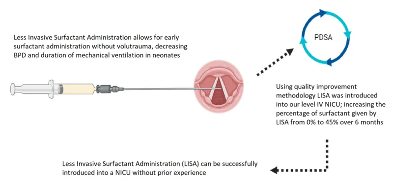 LISA Surfactant Administration Technique Diagram