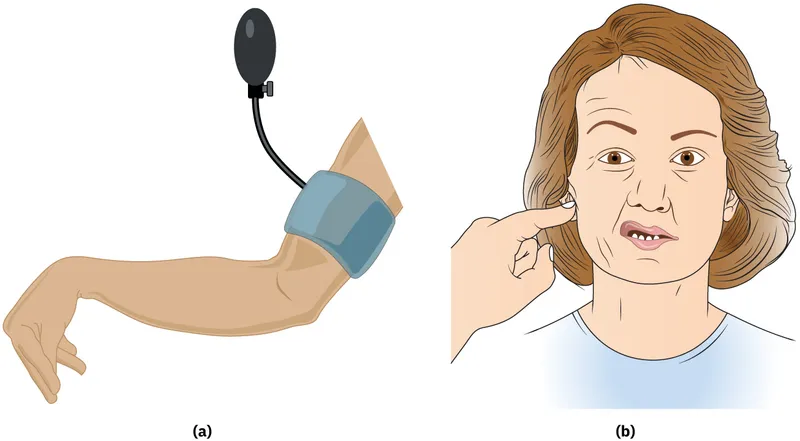 Trousseau's and Chvostek's signs of hypocalcemia
