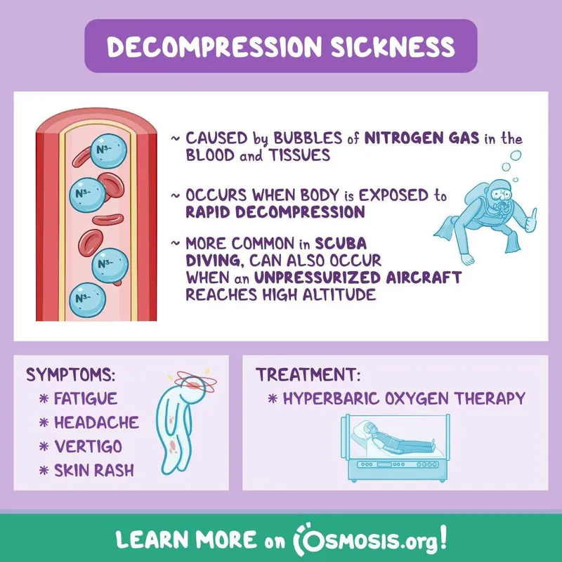 Decompression Sickness: Causes, Symptoms, Treatment