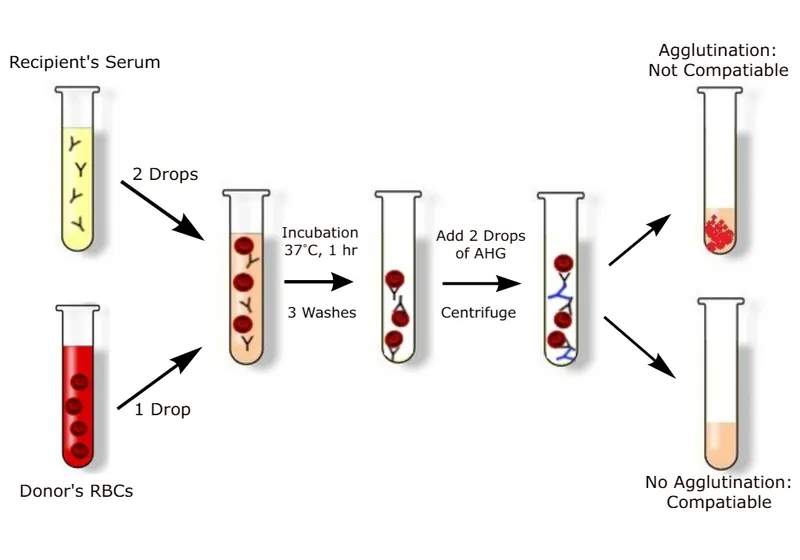 Blood crossmatching procedure diagram