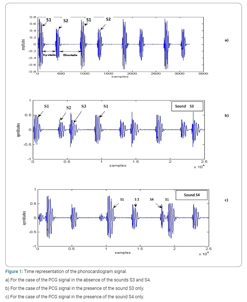 Phonocardiogram of S1, S2, S3, and S4 heart sounds