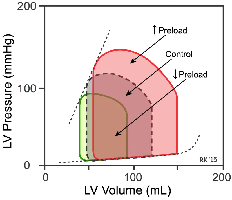 PV loops: increased afterload and diastolic dysfunction