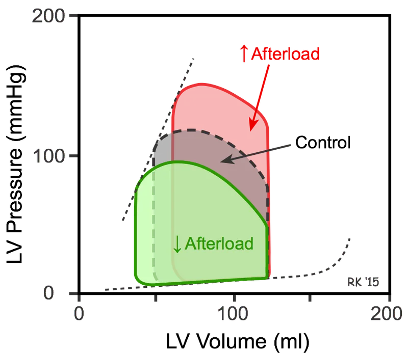 Cardiac PV loop: altered afterload