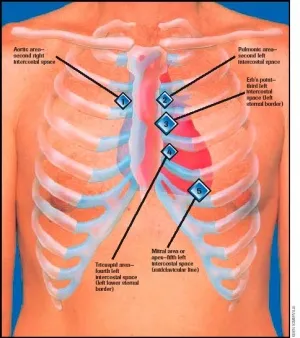 Chest auscultation areas for heart sounds