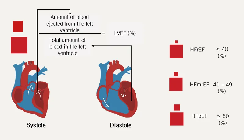 LVEF calculation and heart failure classifications