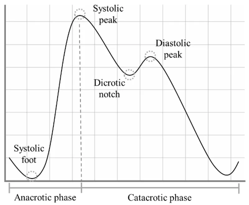 Arterial pulse waveform diagram