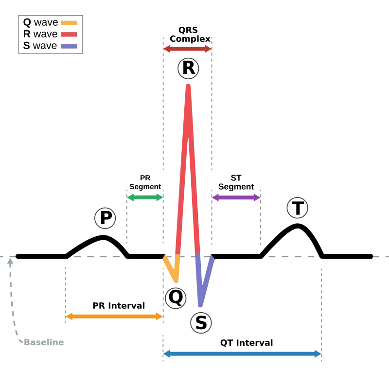 Standard ECG trace with waves, segments, and intervals