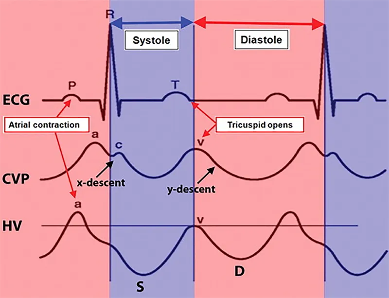 CVP waveform with ECG and Hepatic Venous Flow correlation