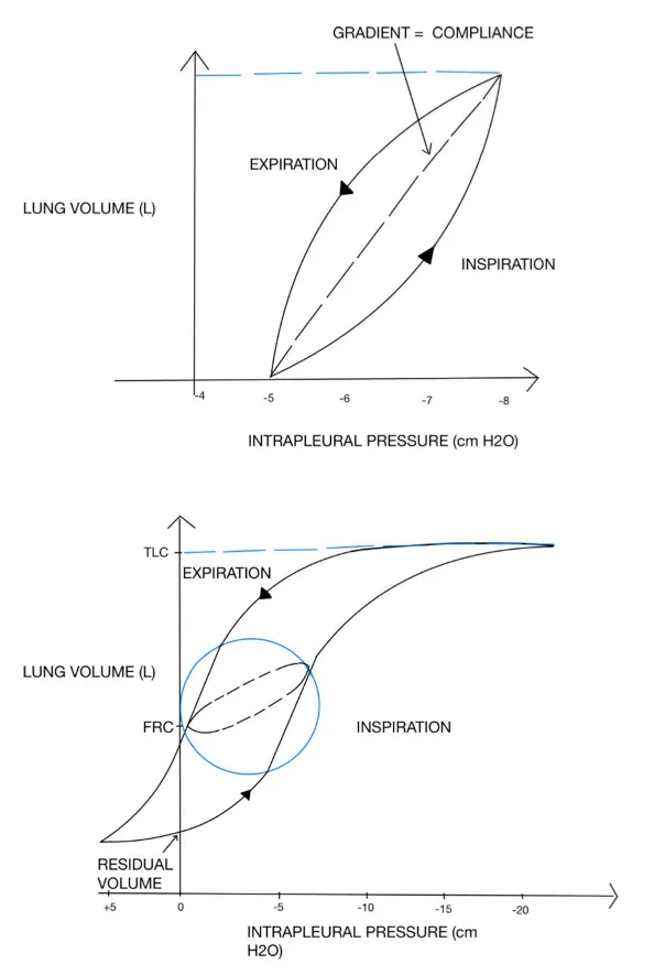 Lung Compliance Curves: Volume vs. Intrapleural Pressure