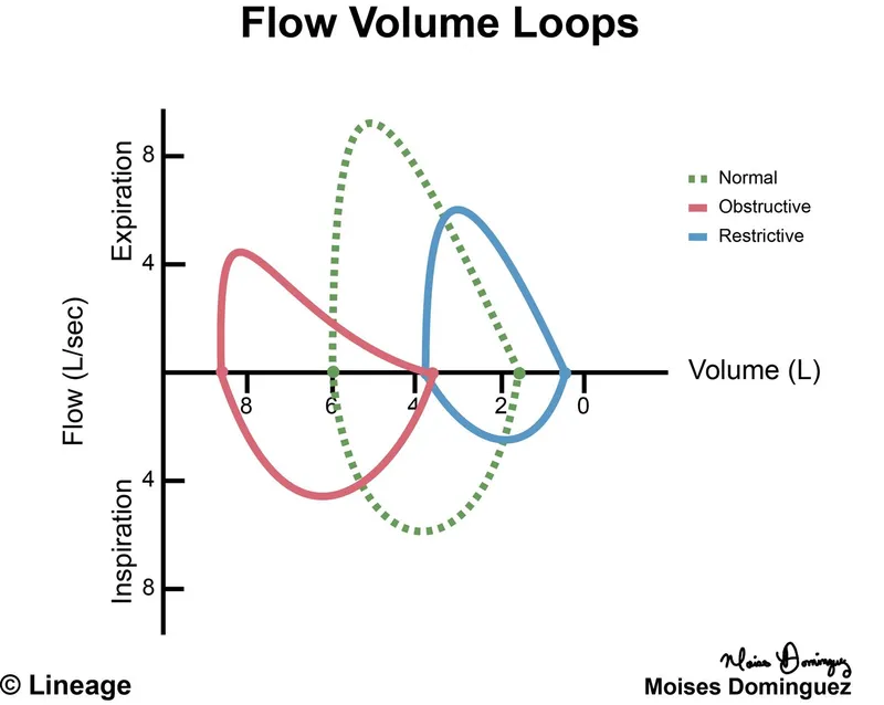Flow-volume loops: normal, obstructive, and restrictive