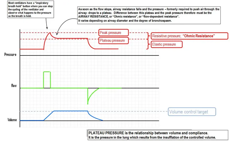 Ventilator pressure waveform with inspiratory hold