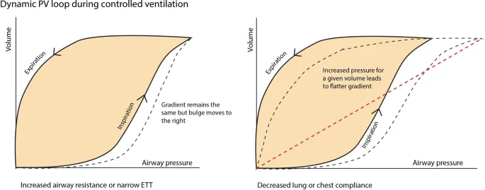 Dynamic PV loops: airway resistance vs. lung compliance