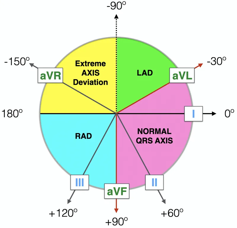 ECG Cardiac Axis Quadrant Method Diagram