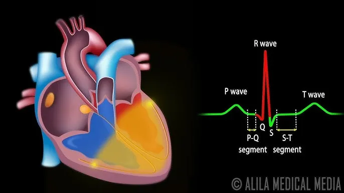 Cardiac conduction system and normal ECG waveform