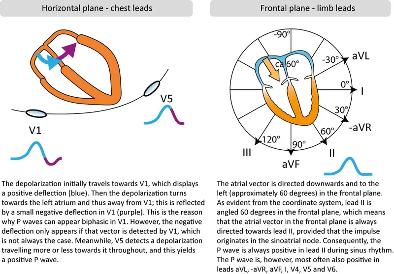 Atrial Depolarization and P-wave Morphology in ECG Leads
