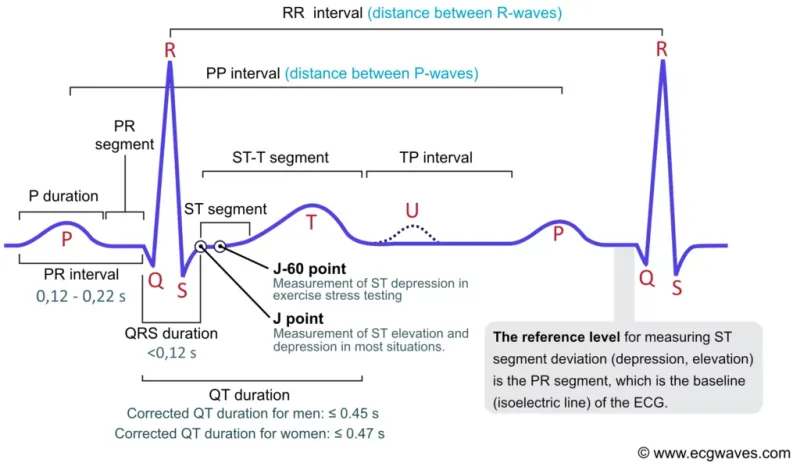 ECG Waveform Components and Intervals