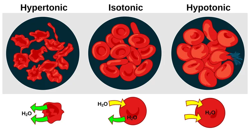 RBCs in Isotonic, Hypotonic, and Hypertonic Solutions