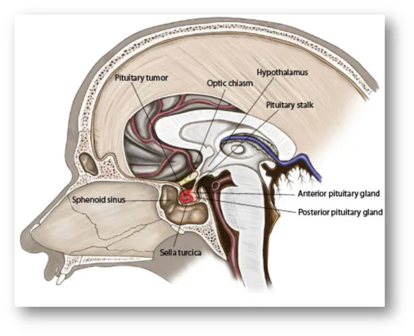 Sagittal view of hypothalamus, pituitary, sella turcica