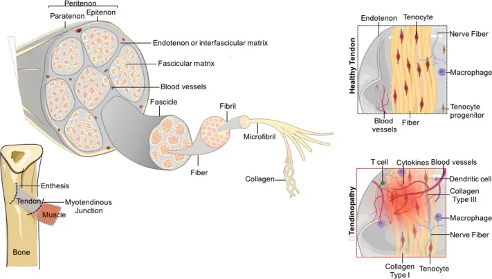 Tendon structure and tendinopathy