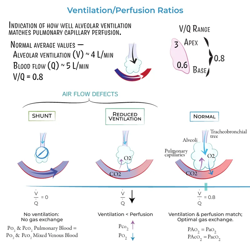 Ventilation/Perfusion Ratios and Air Flow Defects