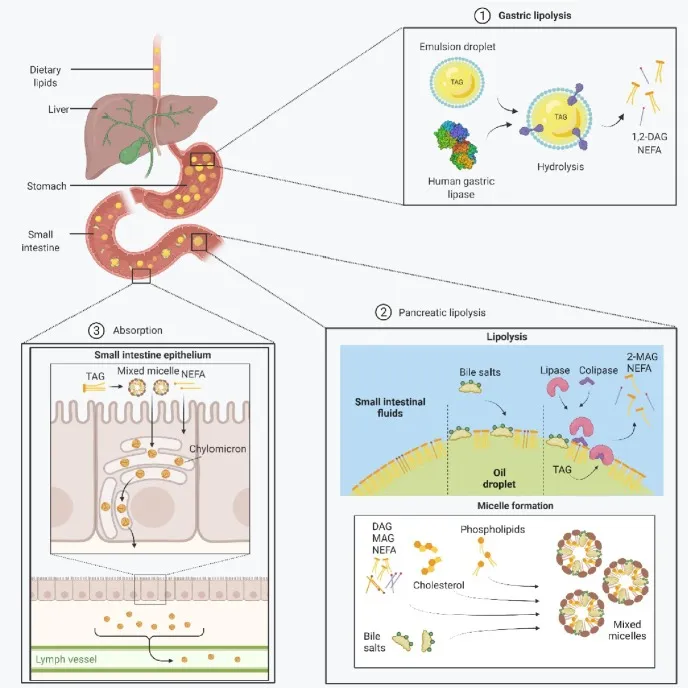 Lipid Digestion and Absorption Pathway
