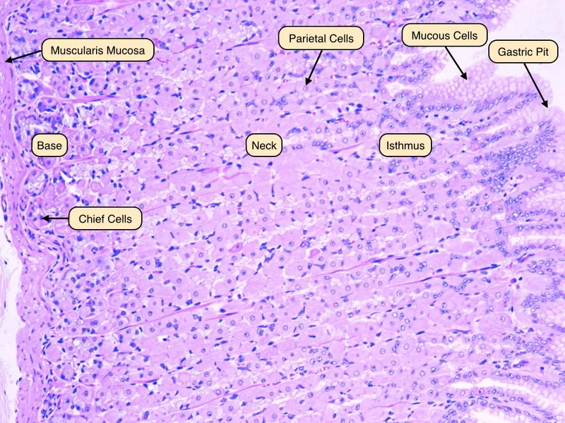 Gastric Chief and Parietal Cells Histology