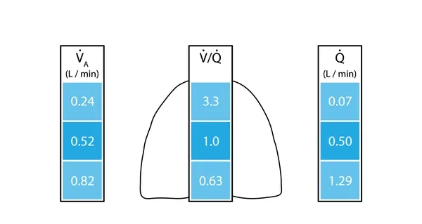 V/Q Ratios in Lung Apex vs. Base