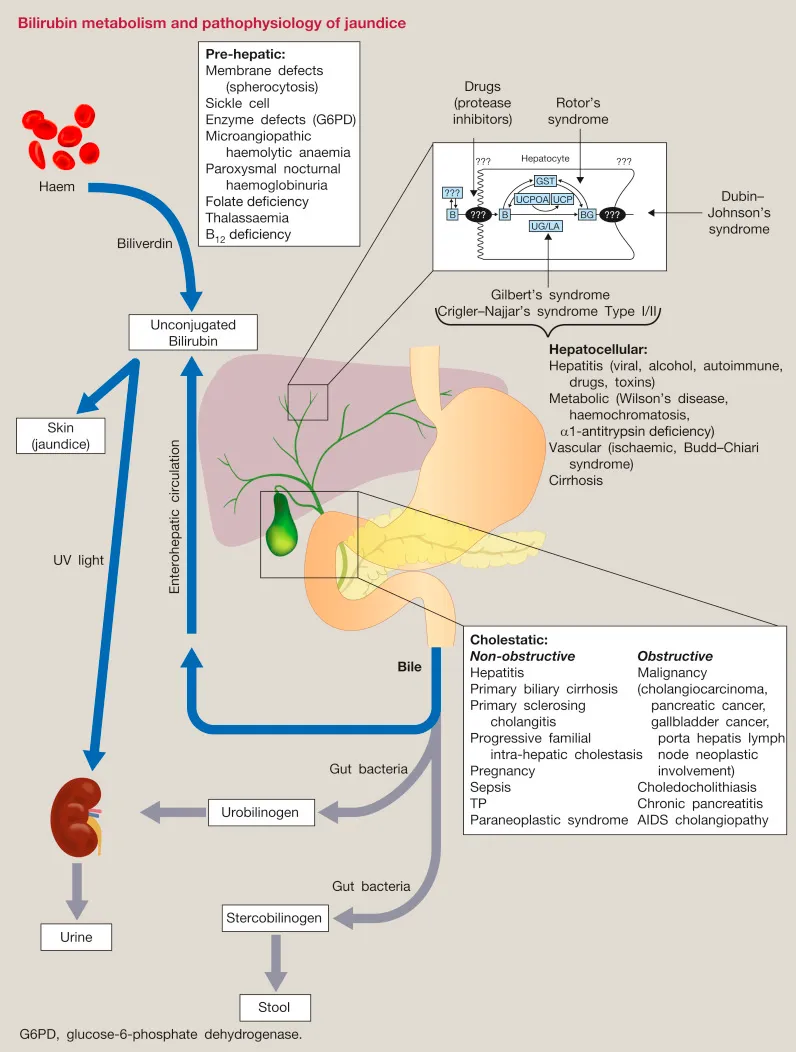 Bilirubin metabolism and jaundice