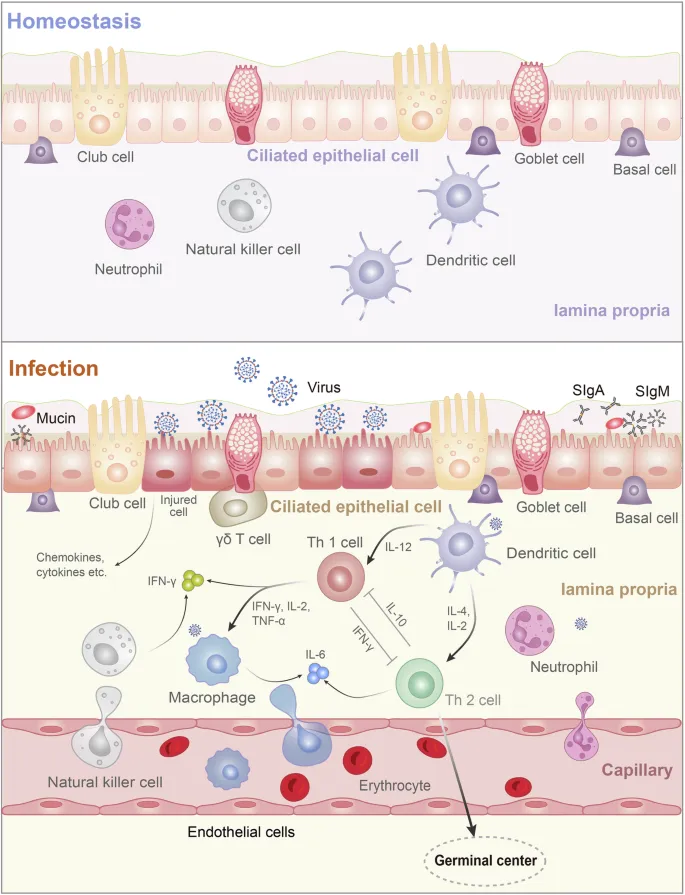 Intestinal Immune Response: Homeostasis vs. Infection