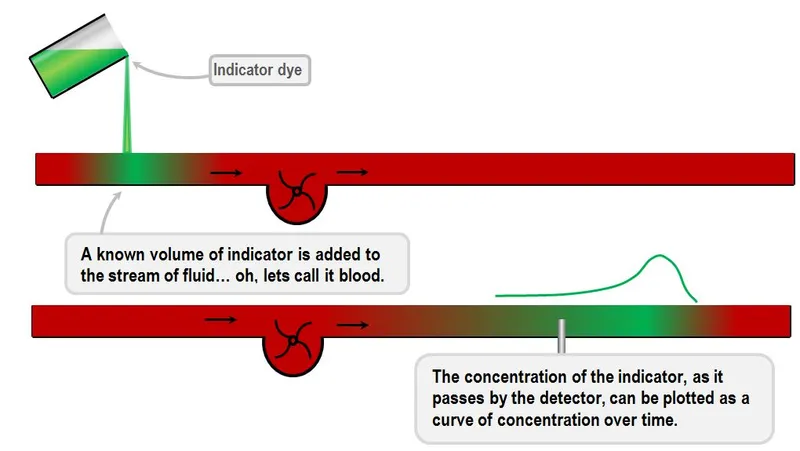 Indicator dilution principle for body fluid measurement