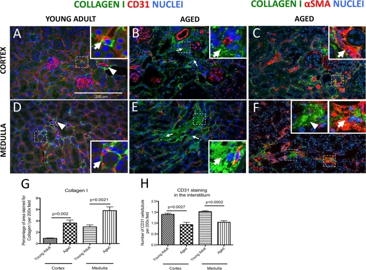Age-related changes in renal collagen and CD31 expression