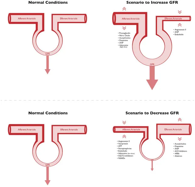 Factors affecting GFR in pathophysiological states