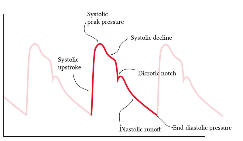 Arterial pressure waveform with labeled components