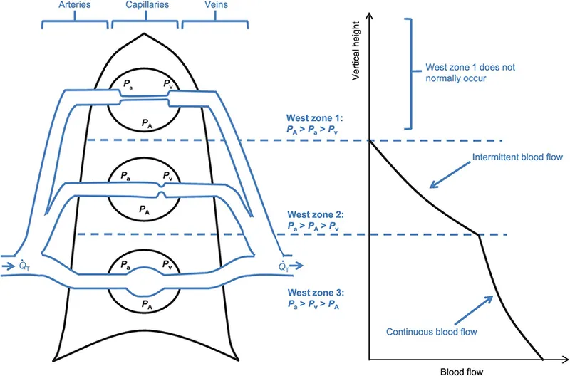 West’s Zones of Pulmonary Blood Flow and Pressures