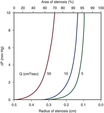 Pressure drop vs. stenosis radius for different flow rates