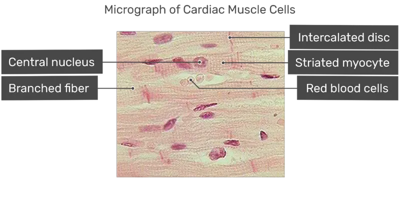 Cardiac Muscle Micrograph with Key Features Labeled
