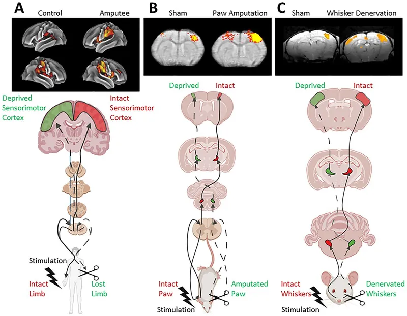 Cortical remapping after limb amputation