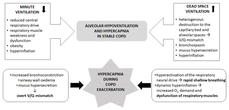 Hypercapnia in Stable COPD vs. Exacerbation