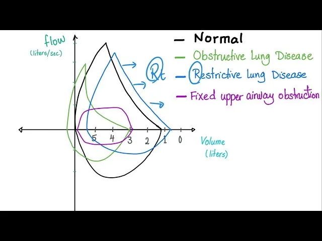 Flow-volume loops: Normal, obstructive, restrictive, fixed