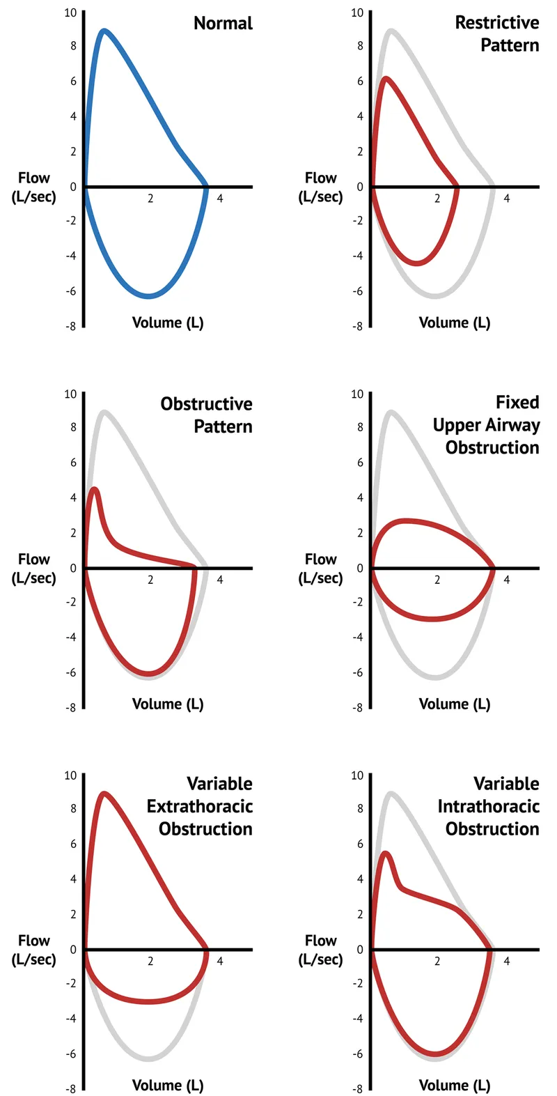Flow-volume loops: normal, obstructive, restrictive