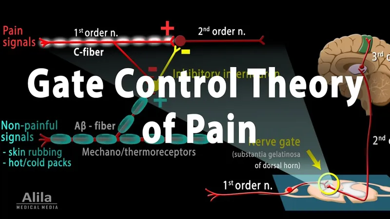 Gate Control Theory of Pain Diagram