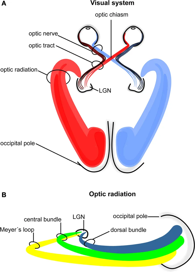 Visual Pathway: Optic Nerve to Occipital Pole