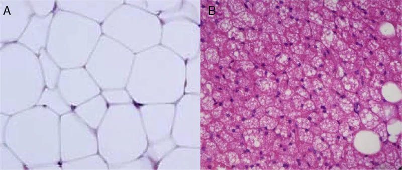 Histology of White vs. Brown Adipose Tissue