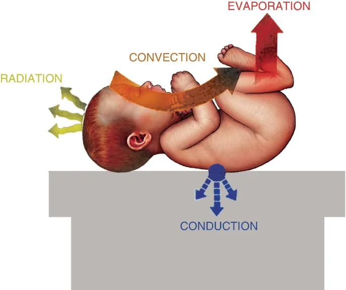 Heat loss mechanisms in neonates