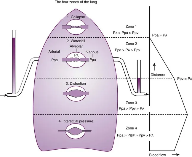 West's Zones of the Lung: Perfusion Differences