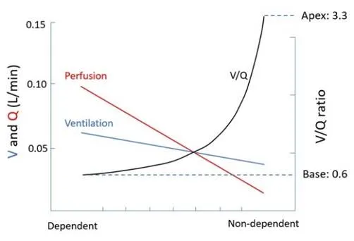 V/Q ratio distribution in the lung