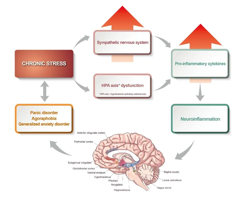 Chronic Stress, Brain Regions, and Anxiety Disorders