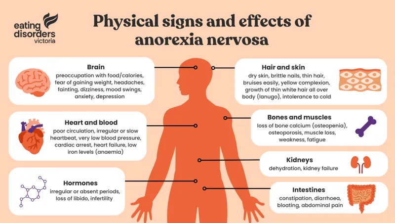 Physical effects of anorexia nervosa