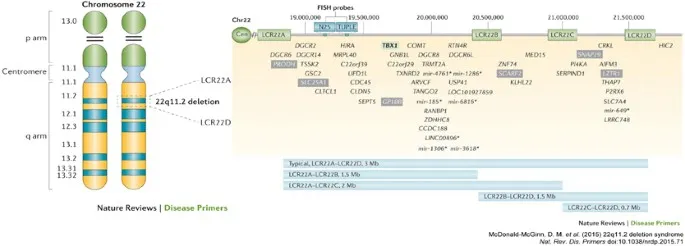 Chromosome 22q11.2 deletion