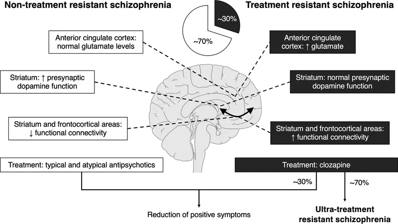 Schizophrenia treatment pathways and brain regions